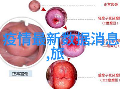 探索全球奇迹那些令人难忘的旅游天堂